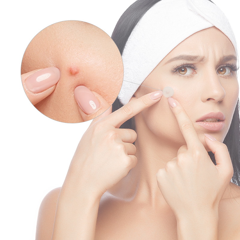 Patch contre l'acné